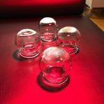 Exploring The Mysteries Of Cupping Therapies