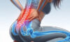 Quick Relief from Sciatica: Get Relief Now!