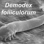 Demodex Mites: Link to Chronic Dry Eye Issues