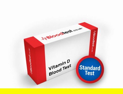 Vitamin D Testing Procedure